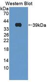 CTSH / Cathepsin H Antibody - Western Blot; Sample: Recombinant protein.