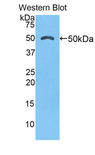 CTSK / Cathepsin K Antibody - Western blot of recombinant CTSK / Cathepsin K.  This image was taken for the unconjugated form of this product. Other forms have not been tested.
