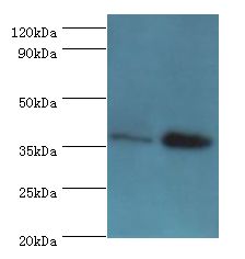 CTSK / Cathepsin K Antibody - Western blot. All lanes: CTSK antibody at 8 ug/ml. Lane 1: MCF-7 whole cell lysate. Lane 2: Rat brain tissue. Secondary antibody: Goat polyclonal to rabbit at 1:10000 dilution. Predicted band size: 37 kDa. Observed band size: 37 kDa.