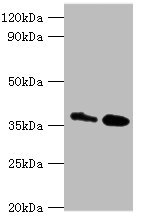 CTSK / Cathepsin K Antibody - Western blot All lanes: CTSK antibody at 8µg/ml Lane 1: MCF-7 whole cell lysate Lane 2: Rat brain tissue Secondary Goat polyclonal to rabbit IgG at 1/10000 dilution Predicted band size: 37 kDa Observed band size: 37 kDa