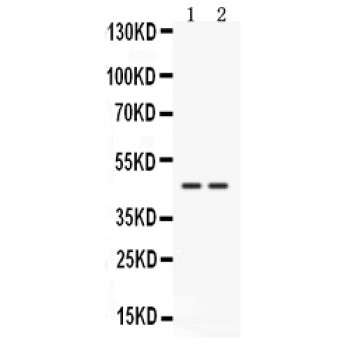 CTSK / Cathepsin K Antibody - Western blot analysis of Cathepsin K expression in HELA whole cell lysates (lane 1) and 22RV1 whole cell lysates (lane 2). Cathepsin K at 45 kD was detected using rabbit anti- Cathepsin K Antigen Affinity purified polyclonal antibody at 0.5 ug/mL. The blot was developed using chemiluminescence (ECL) method.