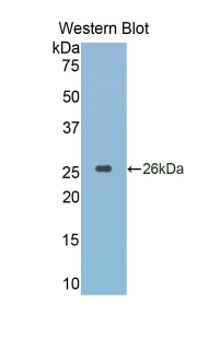 CTSK / Cathepsin K Antibody - Western blot of recombinant CTSK / Cathepsin K.