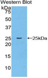 CTSK / Cathepsin K Antibody - Western blot of recombinant CTSK / Cathepsin K.  This image was taken for the unconjugated form of this product. Other forms have not been tested.