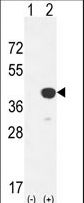 CTSK / Cathepsin K Antibody - Western blot of CTSK (arrow) using rabbit polyclonal CTSK Antibody (Center R222). 293 cell lysates (2 ug/lane) either nontransfected (Lane 1) or transiently transfected with the CTSK gene (Lane 2).