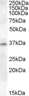 CTSK / Cathepsin K Antibody - Antibody (1 ug/ml) staining of Human Lung lysate (35 ug protein in RIPA buffer). Primary incubation was 1 hour. Detected by chemiluminescence.