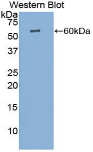 CTSK / Cathepsin K Antibody - Western blot of recombinant CTSK / Cathepsin K.  This image was taken for the unconjugated form of this product. Other forms have not been tested.