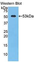 CTSK / Cathepsin K Antibody - Western Blot; Sample: Recombinant protein.