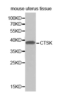 CTSK / Cathepsin K Antibody - Western blot analysis of extracts of mouse uterus tissue cells.