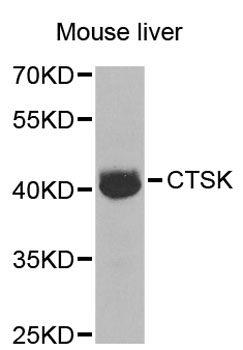CTSK / Cathepsin K Antibody - Western blot analysis of extracts of mouse liver, using CTSK antibody at 1:1000 dilution. The secondary antibody used was an HRP Goat Anti-Rabbit IgG (H+L) at 1:10000 dilution. Lysates were loaded 25ug per lane and 3% nonfat dry milk in TBST was used for blocking. An ECL Kit was used for detection and the exposure time was 30s.