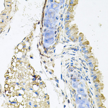 CTSK / Cathepsin K Antibody - Immunohistochemistry of paraffin-embedded mouse lung using CTSK antibodyat dilution of 1:100 (40x lens).