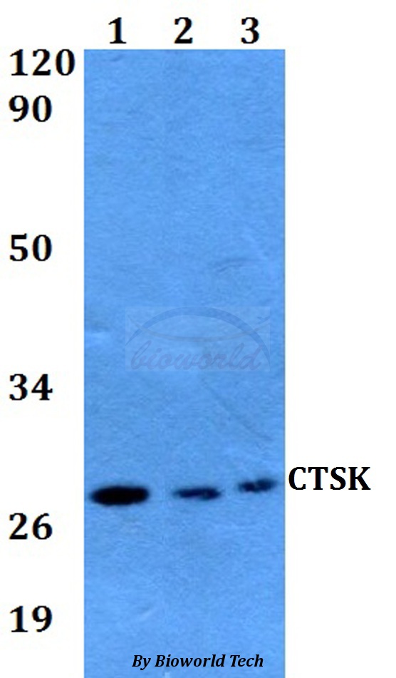 CTSK / Cathepsin K Antibody - Western blot of CTSK antibody at 1:500 dilution. Lane 1: HEK293T whole cell lysate. Lane 2: sp2/0 whole cell lysate. Lane 3: PC12 whole cell lysate.