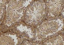 CTSK / Cathepsin K Antibody - 1:100 staining mouse testis tissue by IHC-P. The sample was formaldehyde fixed and a heat mediated antigen retrieval step in citrate buffer was performed. The sample was then blocked and incubated with the antibody for 1.5 hours at 22°C. An HRP conjugated goat anti-rabbit antibody was used as the secondary.