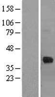 CTSK / Cathepsin K Protein - Western validation with an anti-DDK antibody * L: Control HEK293 lysate R: Over-expression lysate