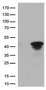 CTSL / Cathepsin L Antibody - HEK293T cells were transfected with the pCMV6-ENTRY control. (Left lane) or pCMV6-ENTRY CTSL. (Right lane) cDNA for 48 hrs and lysed