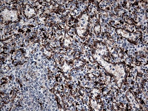 CTSL / Cathepsin L Antibody - Immunohistochemical staining of paraffin-embedded Human spleen tissue within the normal limits using anti-CTSL mouse monoclonal antibody. (Heat-induced epitope retrieval by 1mM EDTA in 10mM Tris buffer. (pH8.5) at 120°C for 3 min. (1:500)
