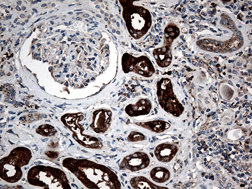 CTSL / Cathepsin L Antibody - Immunohistochemical staining of paraffin-embedded Human Kidney tissue within the normal limits using anti-CTSL mouse monoclonal antibody. (Heat-induced epitope retrieval by 1mM EDTA in 10mM Tris buffer. (pH8.5) at 120°C for 3 min. (1:500)