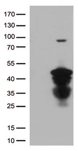 CTSL / Cathepsin L Antibody - HEK293T cells were transfected with the pCMV6-ENTRY control. (Left lane) or pCMV6-ENTRY CTSL. (Right lane) cDNA for 48 hrs and lysed. Equivalent amounts of cell lysates. (5 ug per lane) were separated by SDS-PAGE and immunoblotted with anti-CTSL. (1:500)