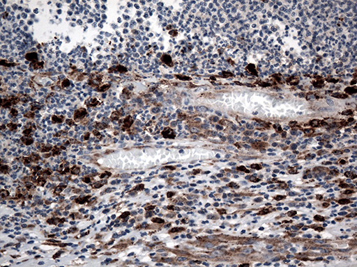 CTSL / Cathepsin L Antibody - Immunohistochemical staining of paraffin-embedded Human thyroid tissue within the normal limits using anti-CTSL mouse monoclonal antibody. (Heat-induced epitope retrieval by 1mM EDTA in 10mM Tris buffer. (pH8.5) at 120°C for 3 min. (1:500)