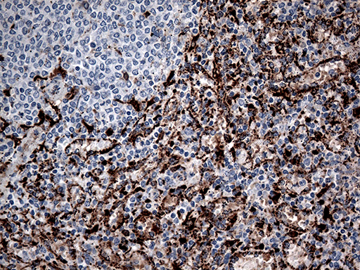 CTSL / Cathepsin L Antibody - Immunohistochemical staining of paraffin-embedded Human spleen tissue within the normal limits using anti-CTSL mouse monoclonal antibody. (Heat-induced epitope retrieval by 1mM EDTA in 10mM Tris buffer. (pH8.5) at 120°C for 3 min. (1:500)