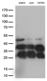 CTSL / Cathepsin L Antibody - Western blot analysis of extracts. (35ug) from 3 cell lines lysates by using anti-CTSL monoclonal antibody. (1:500)