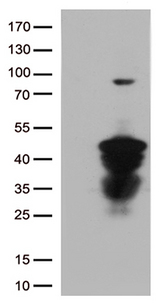CTSL / Cathepsin L Antibody - HEK293T cells were transfected with the pCMV6-ENTRY control. (Left lane) or pCMV6-ENTRY CTSL. (Right lane) cDNA for 48 hrs and lysed