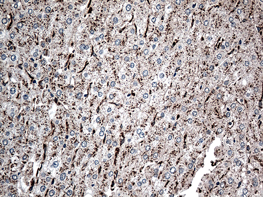 CTSL / Cathepsin L Antibody - Immunohistochemical staining of paraffin-embedded Human liver tissue within the normal limits using anti-CTSL mouse monoclonal antibody. (Heat-induced epitope retrieval by 1mM EDTA in 10mM Tris buffer. (pH8.5) at 120°C for 3 min. (1:500)
