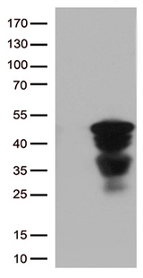 CTSL / Cathepsin L Antibody - HEK293T cells were transfected with the pCMV6-ENTRY control. (Left lane) or pCMV6-ENTRY CTSL. (Right lane) cDNA for 48 hrs and lysed. Equivalent amounts of cell lysates. (5 ug per lane) were separated by SDS-PAGE and immunoblotted with anti-CTSL. (1:500)