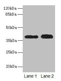 CTSL / Cathepsin L Antibody - Western blot All lanes: CTSL antibody at 12µg/ml Lane 1: A549 whole cell lysate Lane 2: HepG2 whole cell lysate Secondary Goat polyclonal to rabbit IgG at 1/10000 dilution Predicted band size: 37 kDa Observed band size: 37 kDa