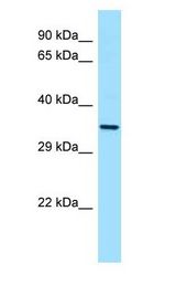 CTSL / Cathepsin L Antibody - CTSL / Cathepsin L antibody Western Blot of HT1080.  This image was taken for the unconjugated form of this product. Other forms have not been tested.