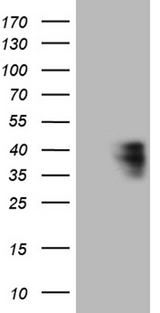 CTSL / Cathepsin L Antibody - HEK293T cells were transfected with the pCMV6-ENTRY control. (Left lane) or pCMV6-ENTRY CTSL. (Right lane) cDNA for 48 hrs and lysed. Equivalent amounts of cell lysates. (5 ug per lane) were separated by SDS-PAGE and immunoblotted with anti-CTSL. (1:2000)