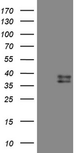 CTSL / Cathepsin L Antibody - HEK293T cells were transfected with the pCMV6-ENTRY control. (Left lane) or pCMV6-ENTRY CTSL1. (Right lane) cDNA for 48 hrs and lysed. Equivalent amounts of cell lysates. (5 ug per lane) were separated by SDS-PAGE and immunoblotted with anti-CTSL1. (1:500)