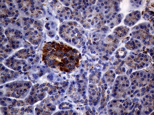 CTSL / Cathepsin L Antibody - Immunohistochemical staining of paraffin-embedded Human pancreas tissue within the normal limits using anti-CTSL1 mouse monoclonal antibody. (Heat-induced epitope retrieval by 1mM EDTA in 10mM Tris buffer. (pH8.5) at 120°C for 3 min. (1:2000)