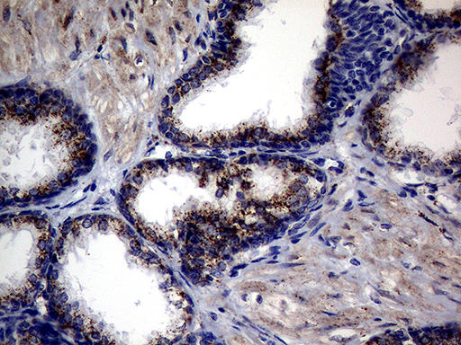 CTSL / Cathepsin L Antibody - Immunohistochemical staining of paraffin-embedded Human prostate tissue within the normal limits using anti-CTSL1 mouse monoclonal antibody. (Heat-induced epitope retrieval by 1mM EDTA in 10mM Tris buffer. (pH8.5) at 120°C for 3 min. (1:2000)