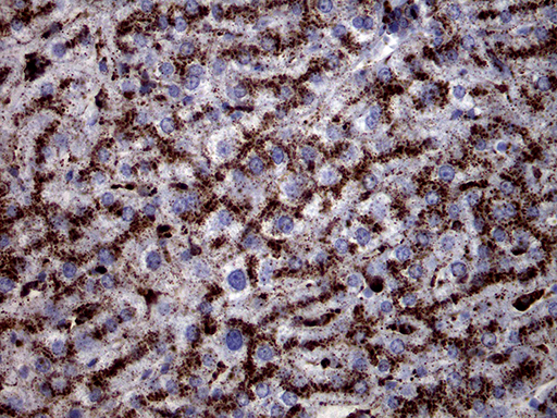 CTSL / Cathepsin L Antibody - Immunohistochemical staining of paraffin-embedded Human liver tissue within the normal limits using anti-CTSL1 mouse monoclonal antibody. (Heat-induced epitope retrieval by 1mM EDTA in 10mM Tris buffer. (pH8.5) at 120°C for 3 min. (1:2000)