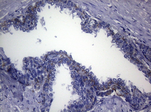 CTSL / Cathepsin L Antibody - Immunohistochemical staining of paraffin-embedded Human prostate tissue within the normal limits using anti-CTSL1 mouse monoclonal antibody. (Heat-induced epitope retrieval by 1mM EDTA in 10mM Tris buffer. (pH8.5) at 120°C for 3 min. (1:150)