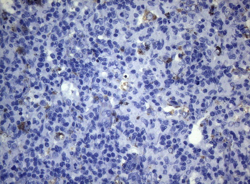 CTSL / Cathepsin L Antibody - Immunohistochemical staining of paraffin-embedded Human lymph node tissue within the normal limits using anti-CTSL1 mouse monoclonal antibody. (Heat-induced epitope retrieval by 1mM EDTA in 10mM Tris buffer. (pH8.5) at 120°C for 3 min. (1:150)