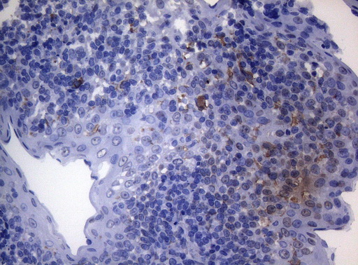 CTSL / Cathepsin L Antibody - Immunohistochemical staining of paraffin-embedded Human tonsil within the normal limits using anti-CTSL1 mouse monoclonal antibody. (Heat-induced epitope retrieval by 1mM EDTA in 10mM Tris buffer. (pH8.5) at 120°C for 3 min. (1:150)