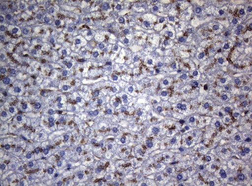 CTSL / Cathepsin L Antibody - Immunohistochemical staining of paraffin-embedded Human liver tissue within the normal limits using anti-CTSL1 mouse monoclonal antibody. (Heat-induced epitope retrieval by 1mM EDTA in 10mM Tris buffer. (pH8.5) at 120°C for 3 min. (1:150)