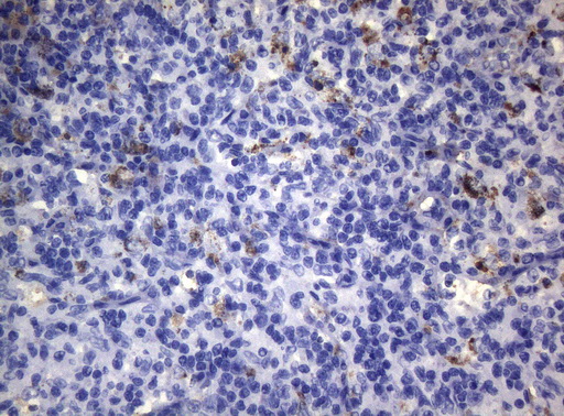 CTSL / Cathepsin L Antibody - Immunohistochemical staining of paraffin-embedded Human lymph node tissue within the normal limits using anti-CTSL1 mouse monoclonal antibody. (Heat-induced epitope retrieval by 1mM EDTA in 10mM Tris buffer. (pH8.5) at 120°C for 3 min. (1:150)