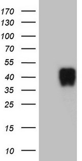 CTSL / Cathepsin L Antibody - HEK293T cells were transfected with the pCMV6-ENTRY control. (Left lane) or pCMV6-ENTRY CTSL1. (Right lane) cDNA for 48 hrs and lysed. Equivalent amounts of cell lysates. (5 ug per lane) were separated by SDS-PAGE and immunoblotted with anti-CTSL1. (1:2000)