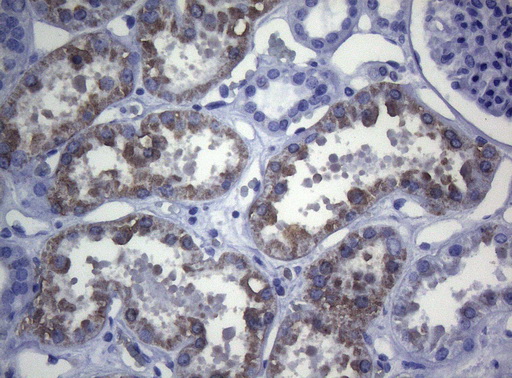 CTSL / Cathepsin L Antibody - Immunohistochemical staining of paraffin-embedded Human Kidney tissue within the normal limits using anti-CTSL1 mouse monoclonal antibody. (Heat-induced epitope retrieval by 1mM EDTA in 10mM Tris buffer. (pH8.5) at 120°C for 3 min. (1:150)
