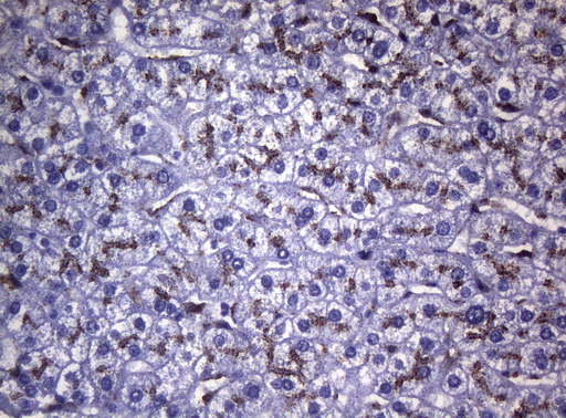 CTSL / Cathepsin L Antibody - Immunohistochemical staining of paraffin-embedded Human liver tissue within the normal limits using anti-CTSL1 mouse monoclonal antibody. (Heat-induced epitope retrieval by 1mM EDTA in 10mM Tris buffer. (pH8.5) at 120°C for 3 min. (1:150)