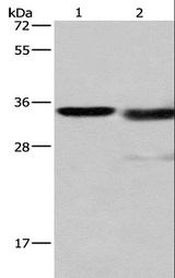 CTSL / Cathepsin L Antibody - Western blot analysis of Mouse kidney tissue and A172 cell, using CTSL Polyclonal Antibody at dilution of 1:900.