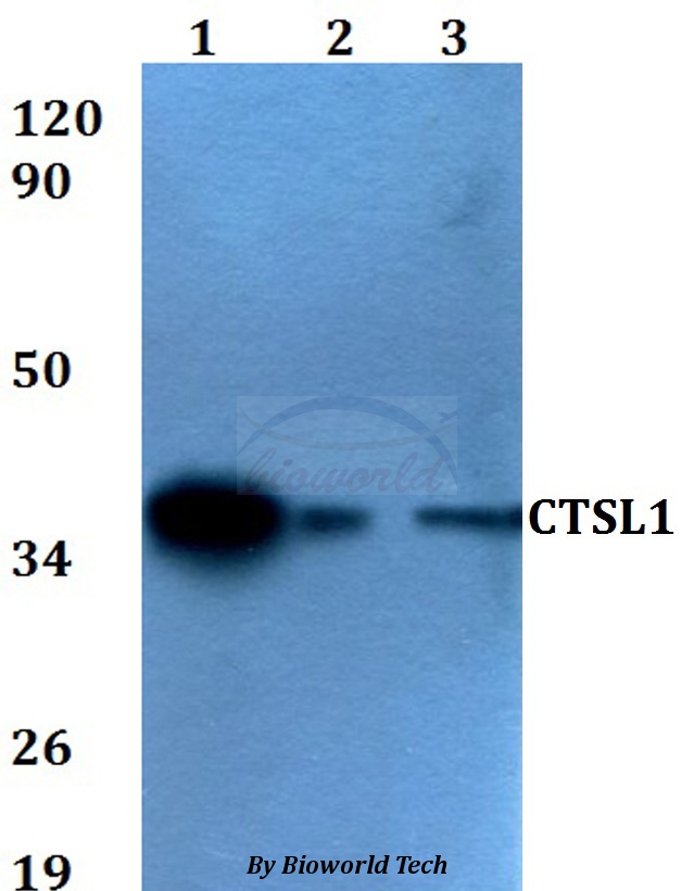 CTSL / Cathepsin L Antibody - Western blot of CTSL1 antibody at 1:500 dilution. Lane 1: HEK293T whole cell lysate. Lane 2: sp2/0 whole cell lysate. Lane 3: PC12 whole cell lysate.