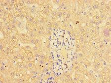 CTSL / Cathepsin L Antibody - Immunohistochemistry of paraffin-embedded human liver tissue using CTSL Antibody at dilution of 1:100