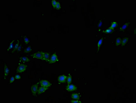 CTSL / Cathepsin L Antibody - Immunofluorescent analysis of HepG2 cells using CTSL Antibody at a dilution of 1:100 and Alexa Fluor 488-congugated AffiniPure Goat Anti-Rabbit IgG(H+L)