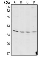 CTSL / Cathepsin L Antibody - Western blot analysis of Cathepsin L HC expression in H9C2 (A), MEF (B), K562 (C), Hela (D) whole cell lysates.