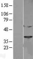 CTSL / Cathepsin L Protein - Western validation with an anti-DDK antibody * L: Control HEK293 lysate R: Over-expression lysate
