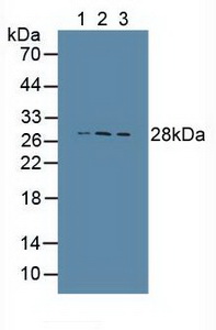 CTSS / Cathepsin S Antibody - Western Blot; Sample: Lane1: Human Lung Tissue; Lane2: Human PANC-1 Cells; Lane3: Human Thymus Tissue.