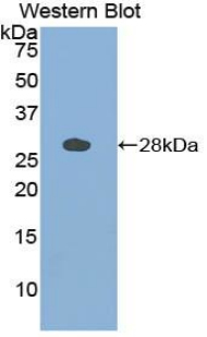 CTSS / Cathepsin S Antibody - Western blot of recombinant CTSS / Cathepsin S.